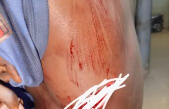 Bohicon : un braquage à main armée déjoué par la police à Avogbanna